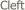  Cleft