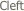  Cleft