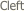  Cleft