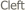  Cleft
